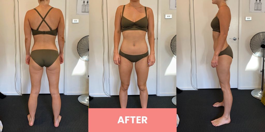 , Rachael’s Thinco Weight Loss Transformation